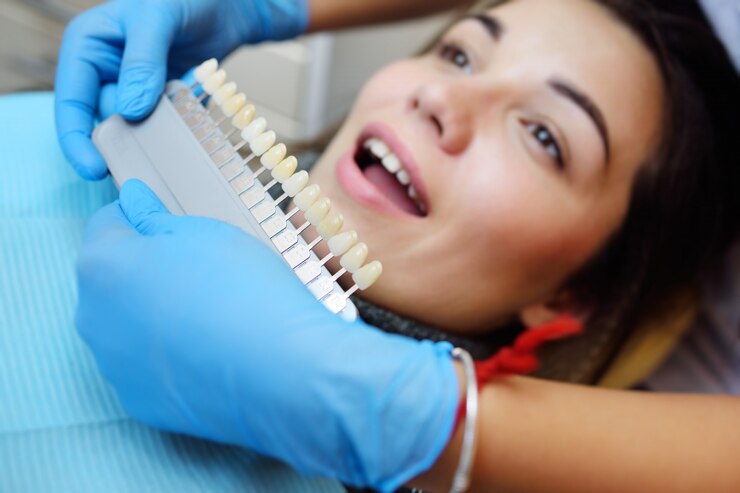 Before a New Smile: The Small Details That Decide How Veneers Will Look on You