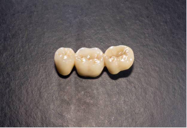 Resin Veneers and Porcelain: What is the Difference?