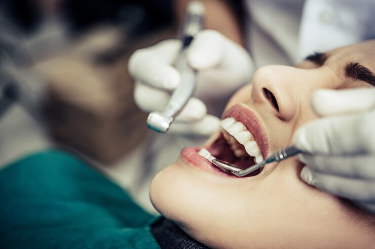 What Are Dental Crowns? Top 7 Things to Know